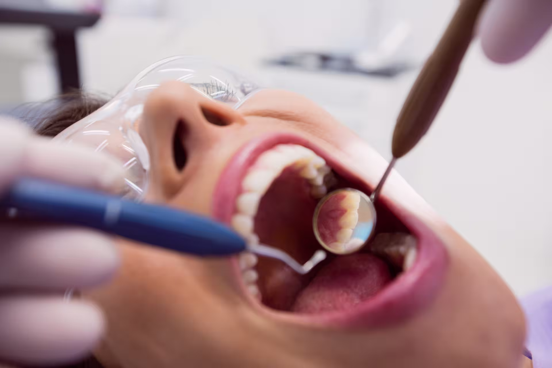 Resultado de Limpieza y valoración en Dental Arquitec, Medellín